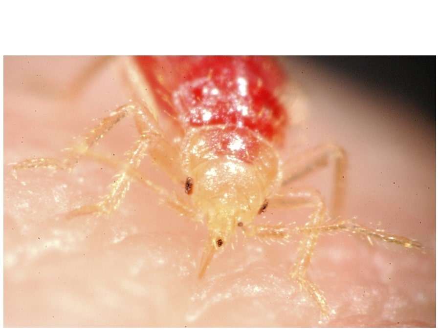 BED BUGS BITE