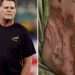 South Africa rugby boss Rassie Erasmus tweets pictures of horror chemical burns after nasty detergent accident