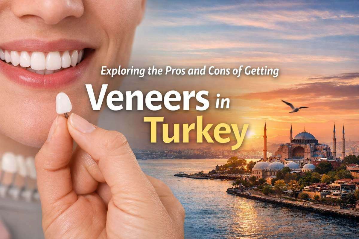 Exploring the Pros and Cons of Getting Veneers in Turkey Exploring the Pros and Cons of Getting Veneers in Turkey